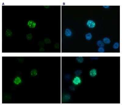 Immunofluorescence: Histone H3 [Trimethyl Lys27, p Ser28] Antibody [NBP2-59161] - HeLa asynchronous cells were stained with the antibody against H3K27me3S28p and with DAPI. Cells were fixed with formaldehyde, permeabilized with sodium citrate and Triton X-100 and blocked with PBS containing 2.5% BSA. FigureA: cells were immunofluorescently labelled with the H3K27me3S28p antibody (diluted 1:200 and incubated for 1 hour at room temperature) followed by goat anti-rabbit antibody conjugated to DyLight 488. FigureB: the nuclei were stained with DAPI, which specifically labels DNA. Phosphorylation of H3 on serine 28 is increased during late G2 phase and reaches a maximum in metaphase cells. This may explain the different staining intensities of different cells.